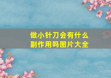 做小针刀会有什么副作用吗图片大全