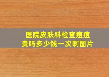 医院皮肤科检查痘痘贵吗多少钱一次啊图片