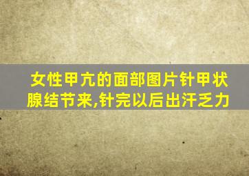 女性甲亢的面部图片针甲状腺结节来,针完以后出汗乏力