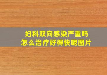 妇科双向感染严重吗怎么治疗好得快呢图片