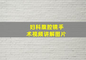 妇科腹腔镜手术视频讲解图片