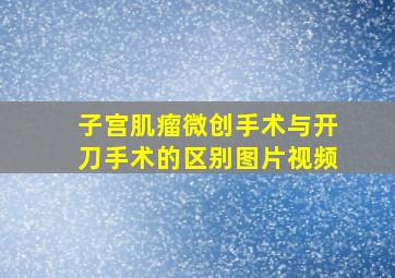 子宫肌瘤微创手术与开刀手术的区别图片视频