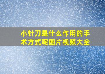 小针刀是什么作用的手术方式呢图片视频大全