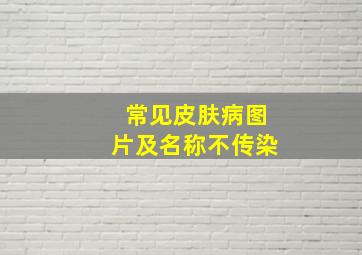 常见皮肤病图片及名称不传染