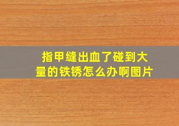 指甲缝出血了碰到大量的铁锈怎么办啊图片