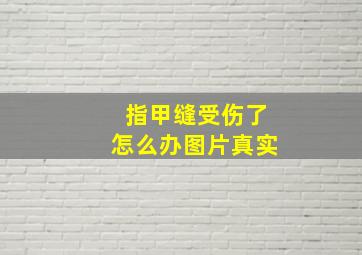 指甲缝受伤了怎么办图片真实