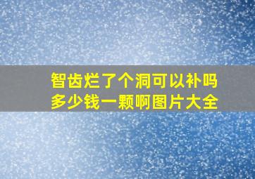 智齿烂了个洞可以补吗多少钱一颗啊图片大全