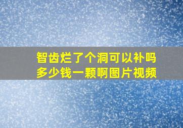 智齿烂了个洞可以补吗多少钱一颗啊图片视频