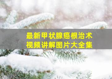 最新甲状腺癌根治术视频讲解图片大全集