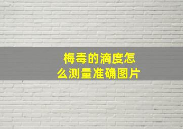 梅毒的滴度怎么测量准确图片