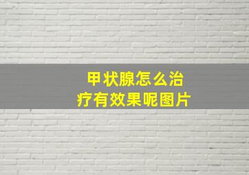 甲状腺怎么治疗有效果呢图片