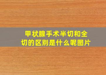 甲状腺手术半切和全切的区别是什么呢图片