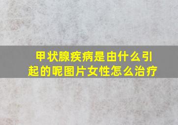 甲状腺疾病是由什么引起的呢图片女性怎么治疗