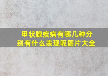 甲状腺疾病有哪几种分别有什么表现呢图片大全