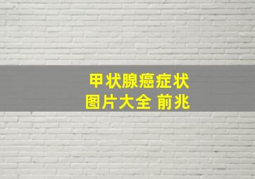 甲状腺癌症状图片大全 前兆