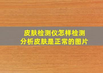 皮肤检测仪怎样检测分析皮肤是正常的图片