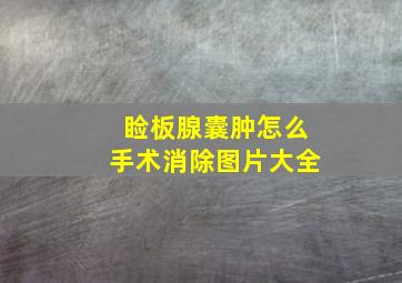 睑板腺囊肿怎么手术消除图片大全