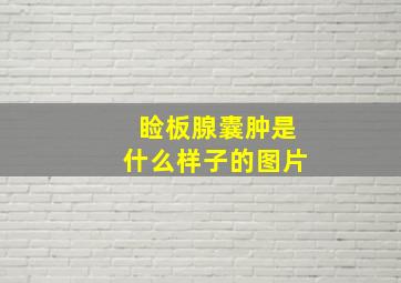 睑板腺囊肿是什么样子的图片