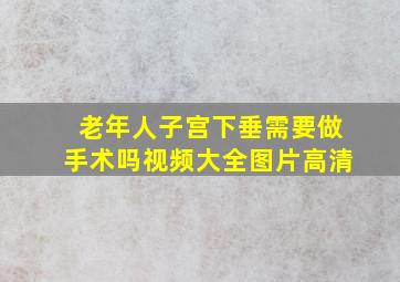 老年人子宫下垂需要做手术吗视频大全图片高清