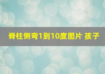 脊柱侧弯1到10度图片 孩子