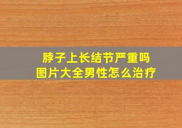 脖子上长结节严重吗图片大全男性怎么治疗