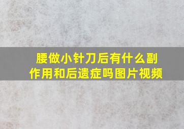 腰做小针刀后有什么副作用和后遗症吗图片视频