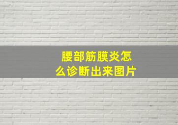 腰部筋膜炎怎么诊断出来图片