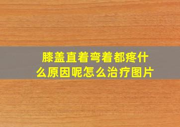 膝盖直着弯着都疼什么原因呢怎么治疗图片