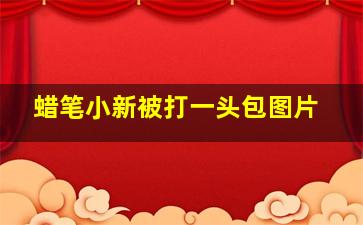 蜡笔小新被打一头包图片