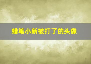 蜡笔小新被打了的头像