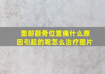 面部颧骨位置痛什么原因引起的呢怎么治疗图片