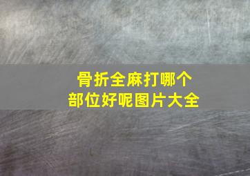 骨折全麻打哪个部位好呢图片大全